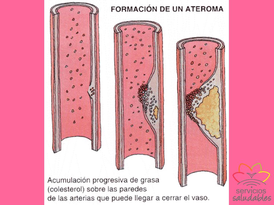 Colesterol: 4 Recomendaciones 